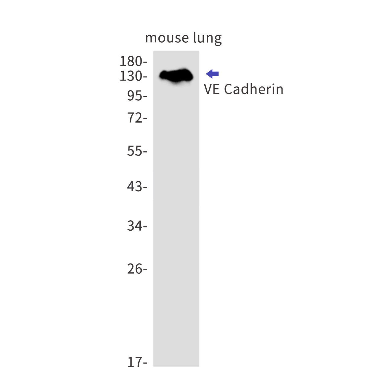 VE Cadherin (14F11) Rabbit Monoclonal Antibody