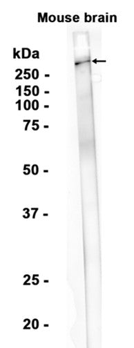 Versican (15C15) Rabbit Monoclonal Antibody