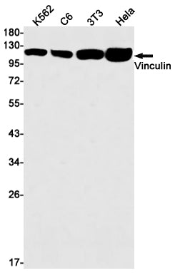 Vinculin (19R11) Rabbit Monoclonal Antibody