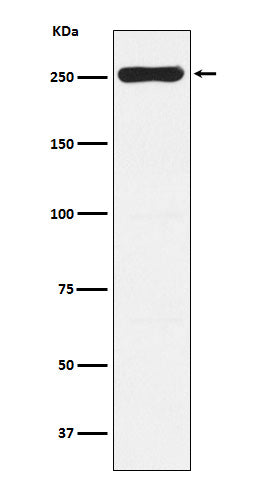 WNK1 (11F15) Rabbit Monoclonal Antibody
