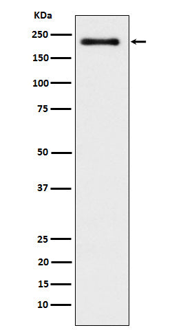 WRN (5Y12) Rabbit Monoclonal Antibody