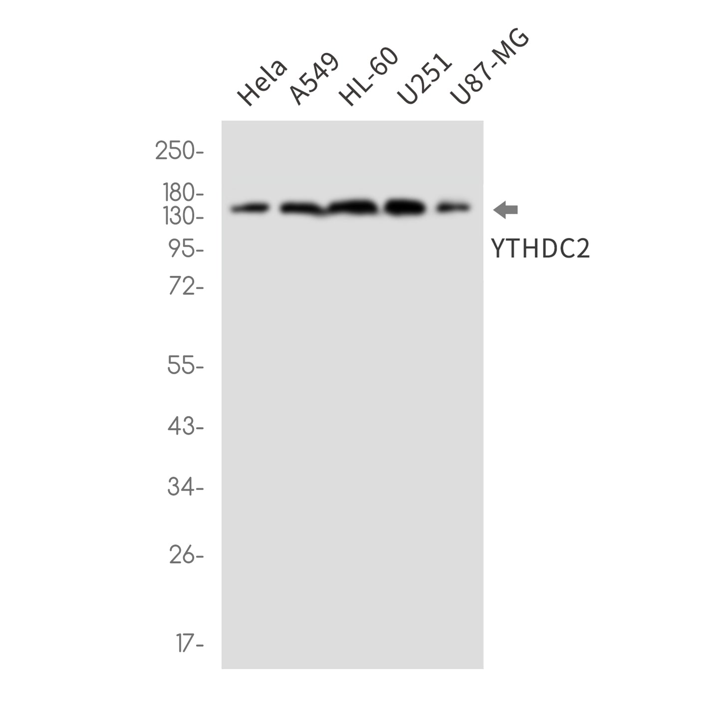 YTHDC2 (5G10) Rabbit Monoclonal Antibody