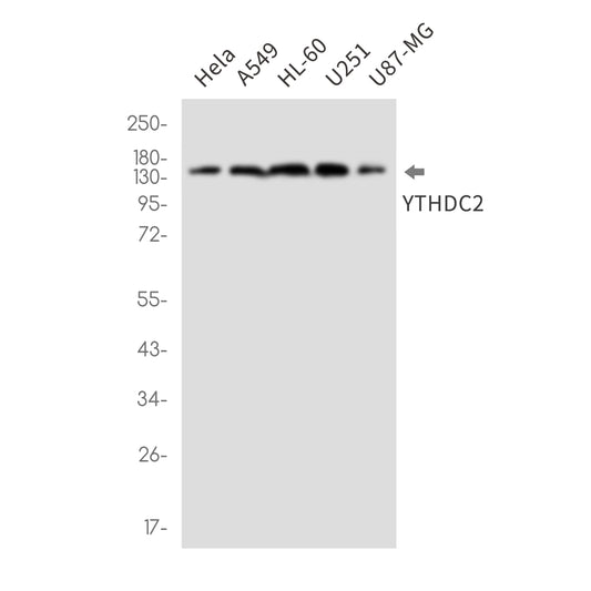 YTHDC2 (5G10) Rabbit Monoclonal Antibody