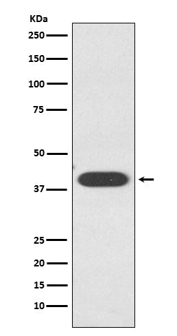 ZA2G / AZGP1 (3J18) Rabbit Monoclonal Antibody