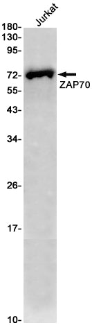 ZAP70 (16U9) Rabbit Monoclonal Antibody