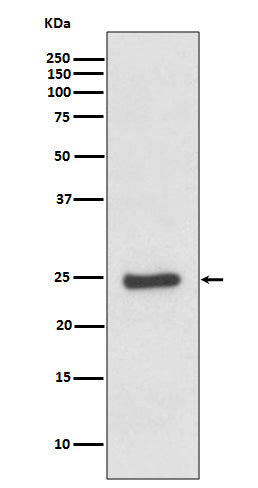 ZNRF2 (3C15) Rabbit Monoclonal Antibody