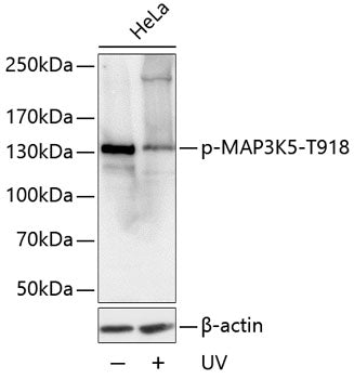 Phospho-MAP3K5-T918 Rabbit pAb