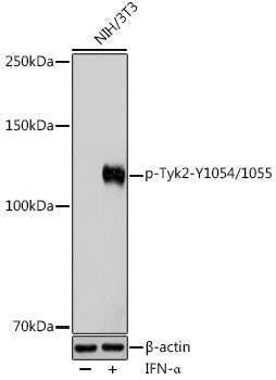 Phospho-Tyk2-Y1054/1055 Rabbit pAb
