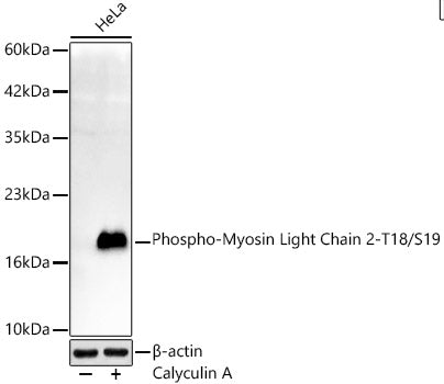 Phospho-Myosin Light Chain 2-T18/S19 Rabbit mAb