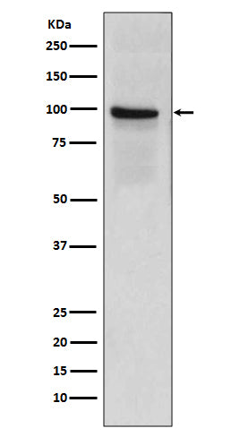 Thrombomodulin Rabbit Polyclonal Antibody