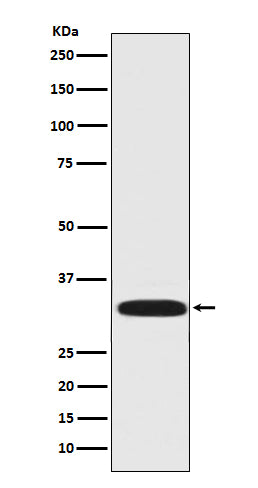 DARPP32 Rabbit Polyclonal Antibody