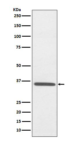 Fibrillarin Rabbit Polyclonal Antibody