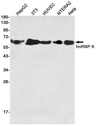 hnRNP K Rabbit Polyclonal Antibody
