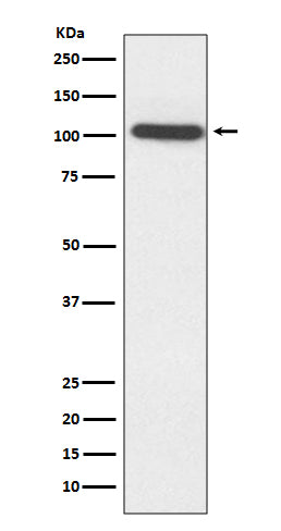 Sarcomeric alpha Actinin Rabbit Polyclonal Antibody