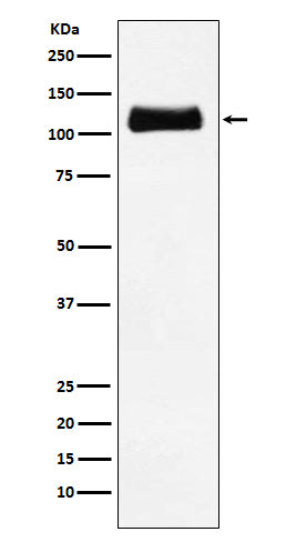 ApoER2 Rabbit Polyclonal Antibody