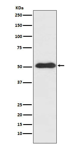 Slit2 Rabbit Polyclonal Antibody