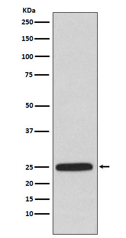 HPRT Rabbit Polyclonal Antibody
