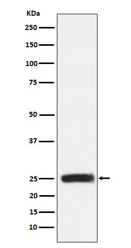 GRB2 Rabbit Polyclonal Antibody