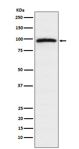 Epac1 Rabbit Polyclonal Antibody