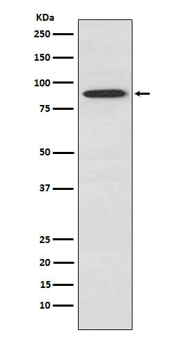 UBA2 Rabbit Polyclonal Antibody