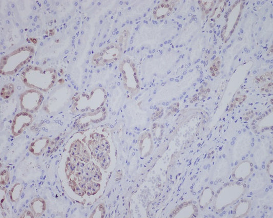 ALK Rabbit Polyclonal Antibody