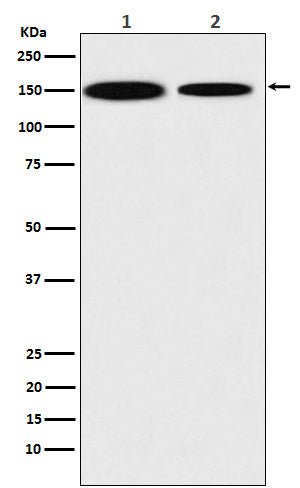 KDM4A Rabbit Polyclonal Antibody
