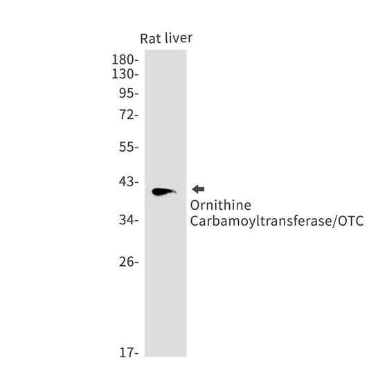 OTC Rabbit Polyclonal Antibody