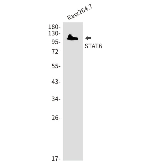 STAT6 Rabbit Polyclonal Antibody