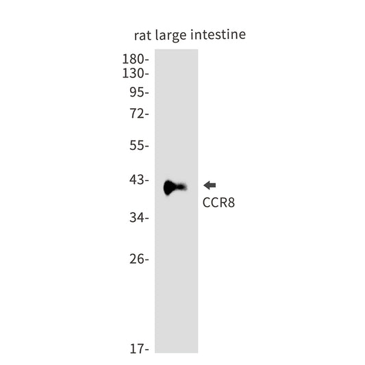 CCR8 Rabbit Polyclonal Antibody