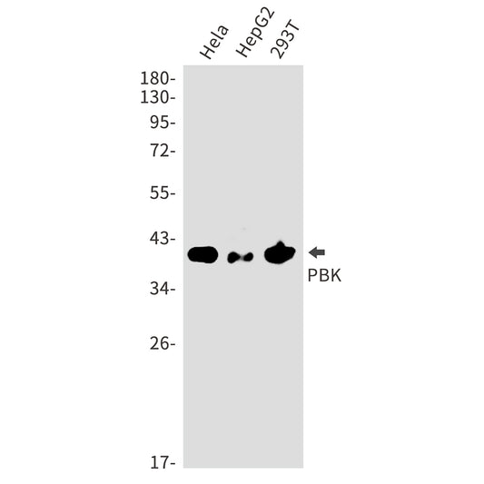 PBK Rabbit Polyclonal Antibody