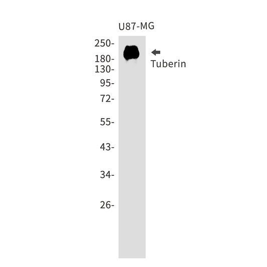 Tuberin Rabbit Polyclonal Antibody