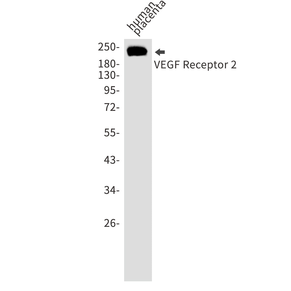 VEGF Receptor 2 Rabbit Polyclonal Antibody