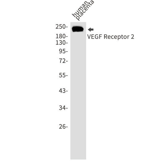VEGF Receptor 2 Rabbit Polyclonal Antibody