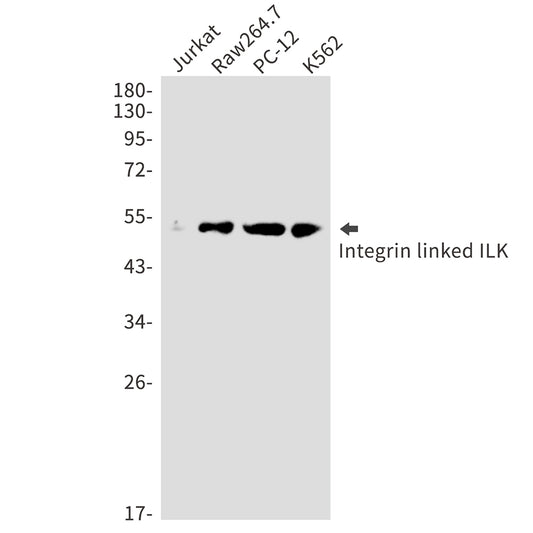 ILK Rabbit Polyclonal Antibody