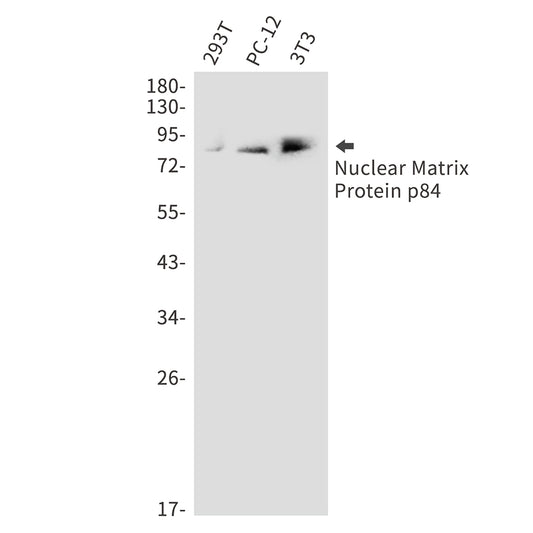 THO Complex Subunit 1 Rabbit Polyclonal Antibody