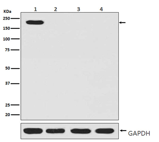 CRISPR Cas9 SP Rabbit Polyclonal Antibody
