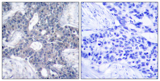 ZAP70 Rabbit Polyclonal Antibody