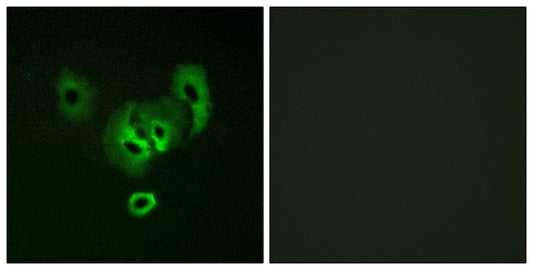 STEAP2 Rabbit Polyclonal Antibody