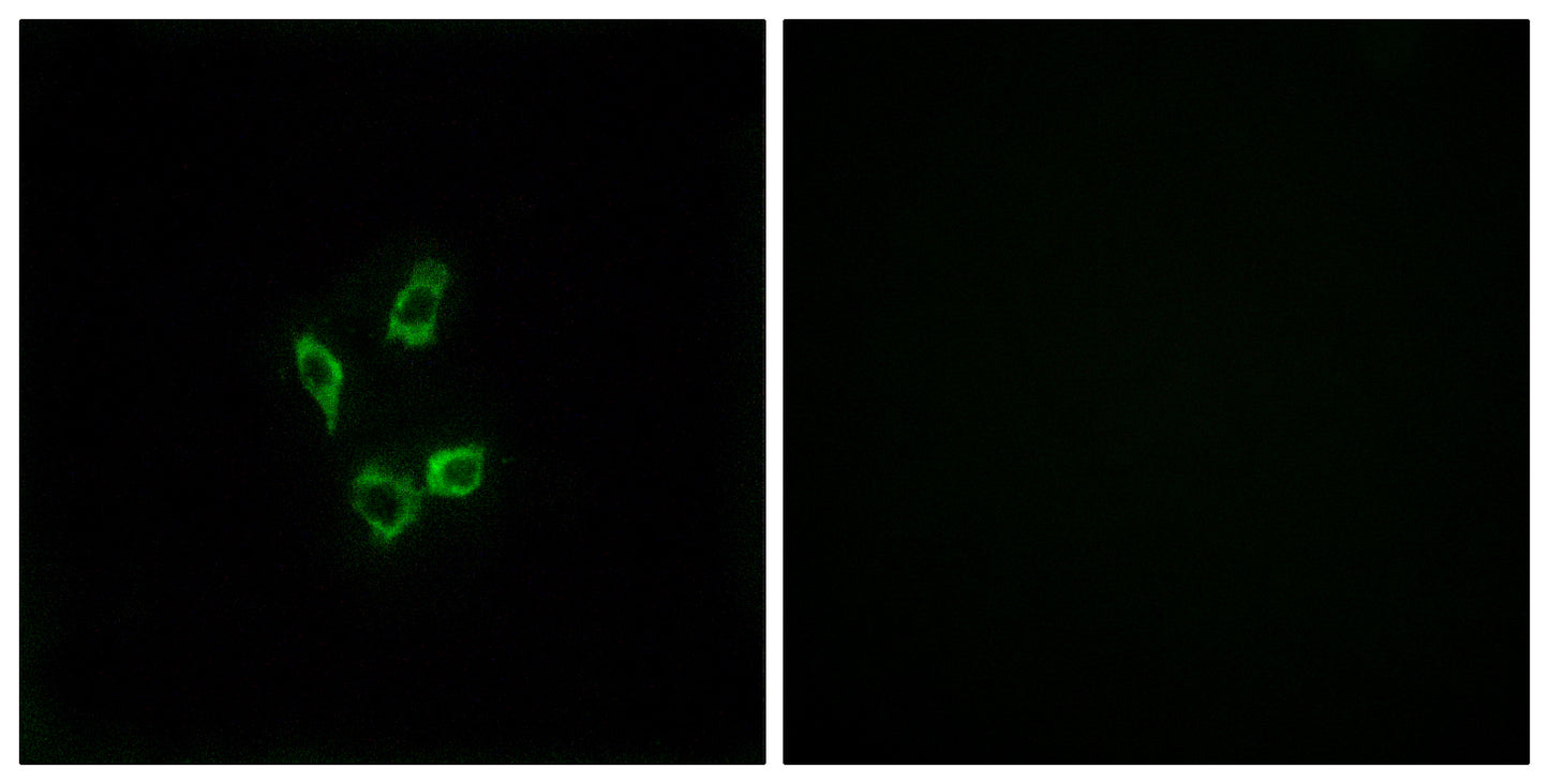 Cytochrome P450 4Z1 Rabbit Polyclonal Antibody