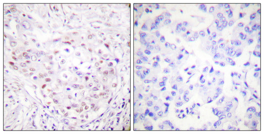 SENP3 Rabbit Polyclonal Antibody