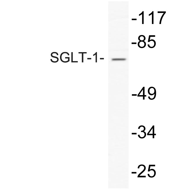 SGLT1 Rabbit Polyclonal Antibody