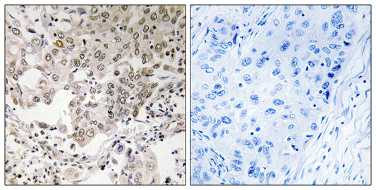 NCAPG2 Rabbit Polyclonal Antibody