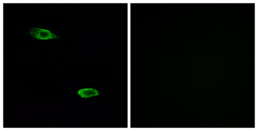 PSGR Rabbit Polyclonal Antibody