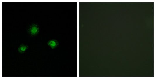 Ubinuclein 1 Rabbit Polyclonal Antibody