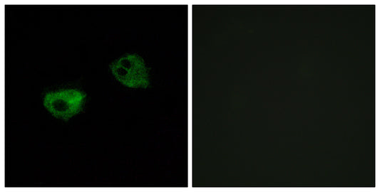 Melatonin Receptor 1A Rabbit Polyclonal Antibody