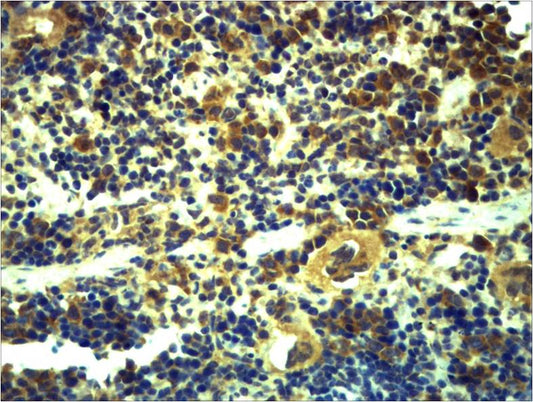Toll-Like Receptor 6 Rabbit Polyclonal Antibody