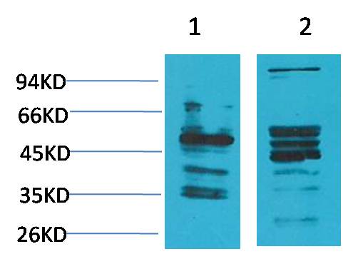 Neuromedin B Receptor Rabbit Polyclonal Antibody