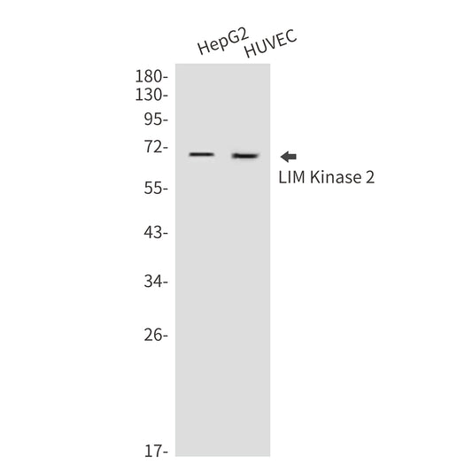 LIM Kinase 2 Rabbit Polyclonal Antibody