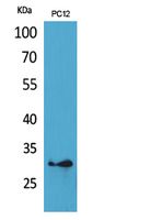 HLA DQB1/2 Rabbit Polyclonal Antibody