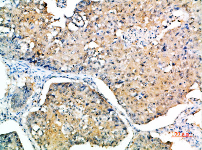 SOCS3 Rabbit Polyclonal Antibody